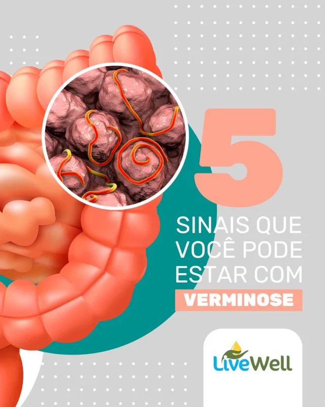 As verminoses são mais comuns do que parecem — e muitas vezes silenciosas. A contaminação pode ocorrer pela ingestão de água ou alimentos contaminados, falta de higiene ou contato com solo infectado.

⚠️ Veja 5 sintomas clássicos que indicam a presença de parasitas no organismo:
1️⃣ Dor abdominal frequente
2️⃣ Diarreia ou prisão de ventre constante
3️⃣ Perda de peso sem motivo aparente
4️⃣ Fadiga excessiva
5️⃣ Coceira anal

👉 Se você identificou esses sinais no seu dia a dia, é hora de investigar e iniciar um processo de desparasitação!

Desintoxicar é se libertar do que adoece o corpo em silêncio 💧

#saudenatural #aromaterapia #saudemental #terapiaortomolecular #fitoterapia #saudeintegrativa #medicinaalternativa #medicinanatural #nutrição #florais #homeopatia #terapiaalternativa #terapiaintegrativa #ortomolecular